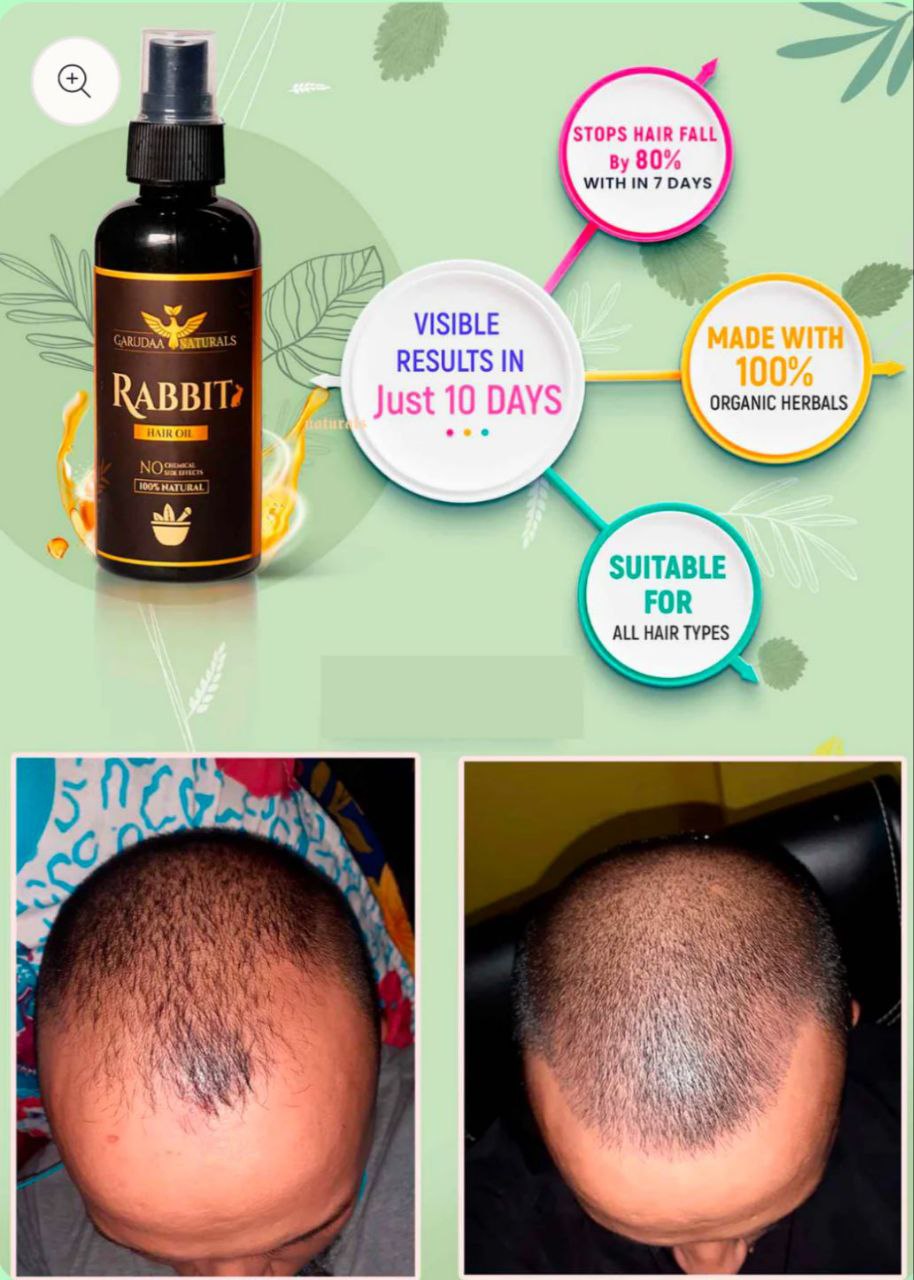 Rabbit Blood Hair Oil(5.0 ⭐⭐⭐⭐⭐ 30,845 REVIEWS) Globally