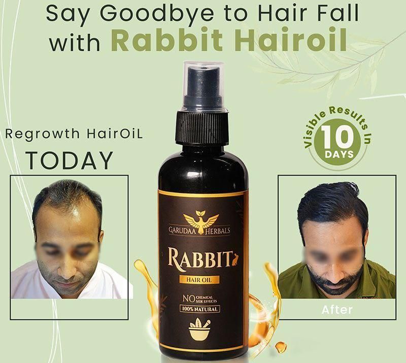 Rabbit Blood Hair Oil(5.0 ⭐⭐⭐⭐⭐ 30,845 REVIEWS) Globally